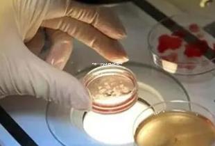 泰国dhc生殖中心医院的试管技术怎么样?多个方面分析! 泰国dhc生殖中心医院的试管技术怎么样?多个方面分析!