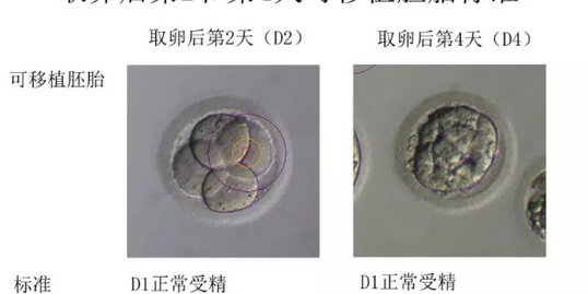 可移植胚胎的标准