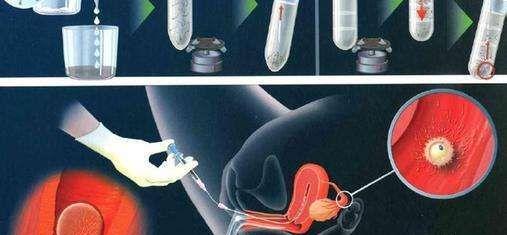胚胎移植过程图