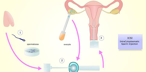 试管一次成功的概率