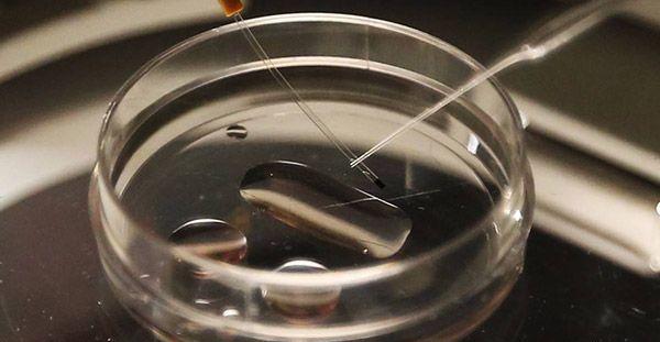 俄罗斯第一代试管婴儿技术