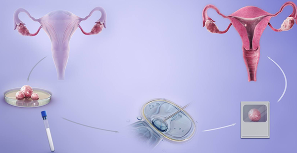 邵逸夫试管成功率高吗