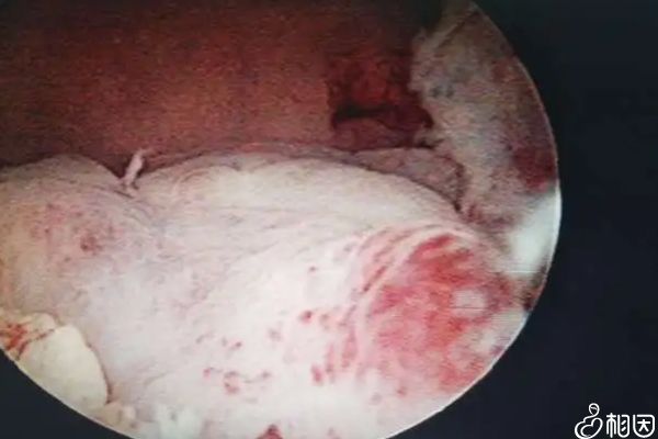 打立生素好处多