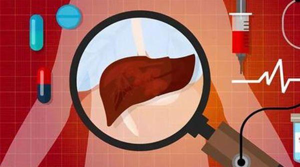 肝功能检查费用因地而异