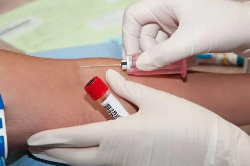 备孕别太早去医院抽血查早孕，这三点原因告诉你答案