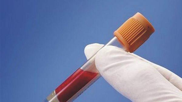 全套肝功能检查需花费600元