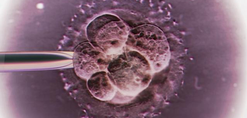 试管婴儿移植后出血要紧吗