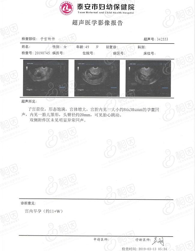49岁H姐的孕期检查报告
