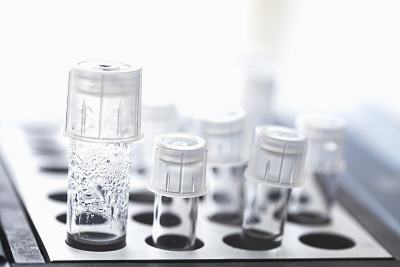 哪些情况的人群适合做试管婴儿？