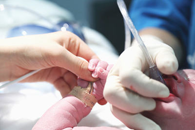 格鲁吉亚取卵手术分享，整个过程大致3~10分钟