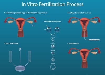 移植第十天出血像月经正常吗？