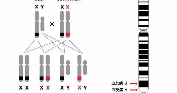 血友病如何遗传