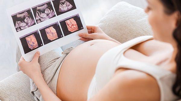 深圳四维彩超医院择