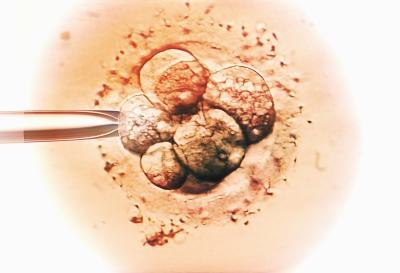 上海仁济医院生殖中心在哪个院区，不清楚地址看这里