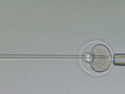 试管婴儿抗结剂方案好吗？利弊对比就知道！