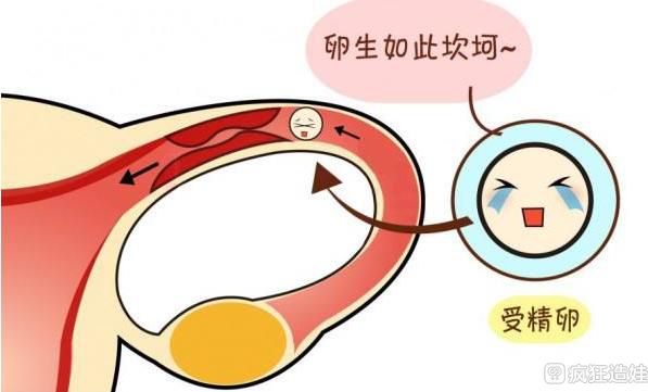 输卵管粘连能做第四代试管婴儿吗